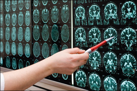 MRI����ϵ�y(t��ng)���ݶȾ�Ȧ