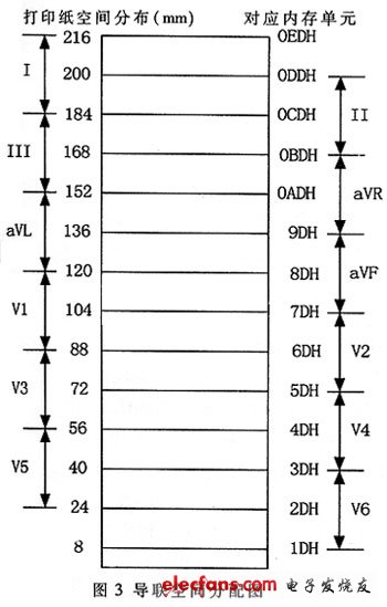 為各個(gè)導(dǎo)聯(lián)分配的熱敏打印紙空間與緩沖內(nèi)存單元