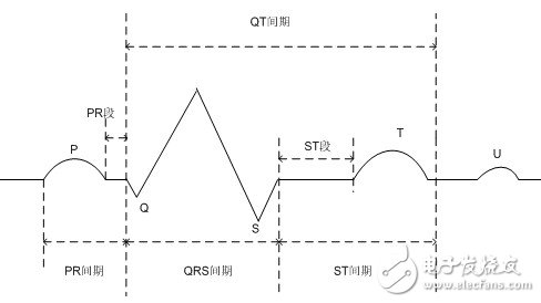 圖1.1 標(biāo)準(zhǔn)心電信號的波形組成
