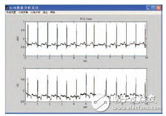 基于生物反饋技術(shù)的可穿戴式心電監(jiān)測系統(tǒng)的設(shè)計