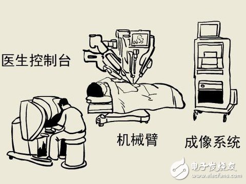 全球最先進的達芬奇手術(shù)機器人技術(shù)解析 