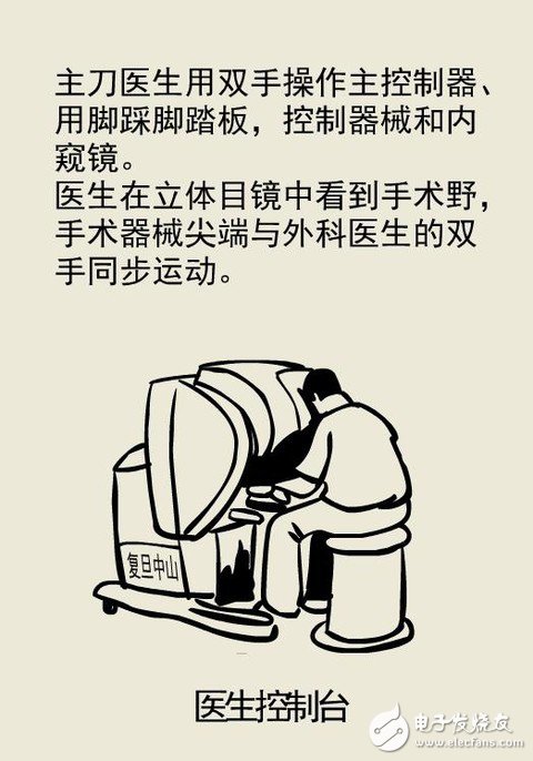 全球最先進的達芬奇手術(shù)機器人技術(shù)解析 