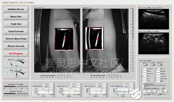 利用3D光學(xué)和聲學(xué)影像的抽血機(jī)器人可實(shí)現(xiàn)幾乎100%一次抽血成功