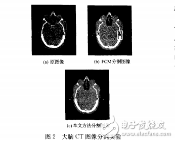 基于FCM聚類(lèi)算法的新型圖像分割算法分析