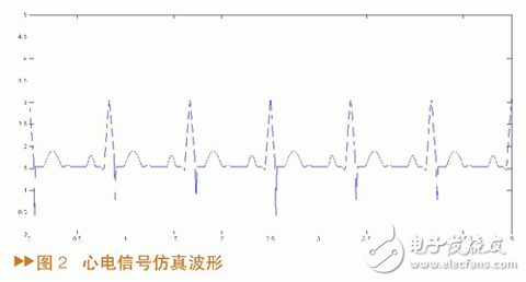 如何設(shè)計(jì)一個(gè)基于MATLAB/SIMULINK的心電信號(hào)仿真方法？