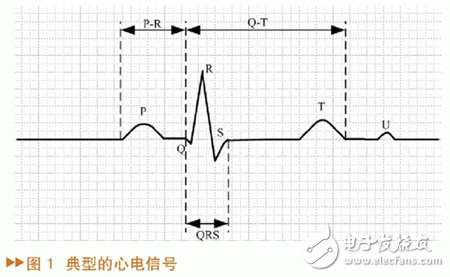 如何設(shè)計(jì)一個(gè)基于MATLAB/SIMULINK的心電信號(hào)仿真方法？