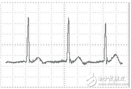 基于STM32芯片和TFT-LCD的便攜式心電圖儀設(shè)計(jì)