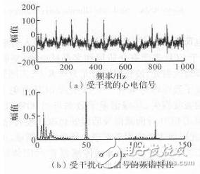 心電信號(hào)檢測(cè)中濾除肌電干擾的方法解析