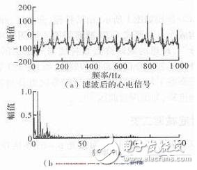 心電信號(hào)檢測(cè)中濾除肌電干擾的方法解析