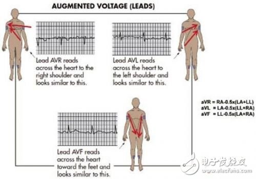 利用ECG AFE簡化病人監(jiān)護儀設(shè)計