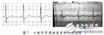 BIH心電數(shù)據(jù)D／A回放設(shè)計(jì)