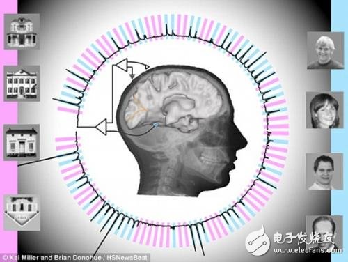 腦電波技術(shù)再上一層樓，讀心準(zhǔn)確率高達(dá)95%